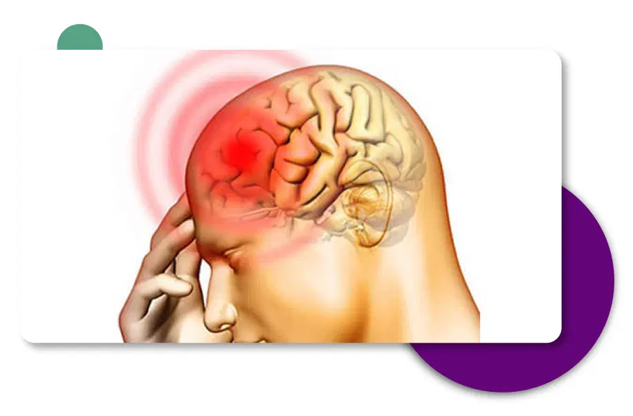 Brain Hemorrhage Treatment in Gurgaon, Delhi - India